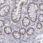 TRIM60 Polyclonal Antibody