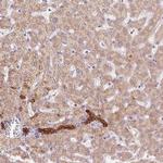 ARHGAP32 Polyclonal Antibody