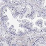 ENO4 Antibody in Immunohistochemistry (IHC)