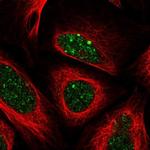 ALKBH8 Polyclonal Antibody