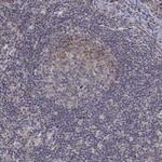 ALKBH8 Antibody in Immunohistochemistry (Paraffin) (IHC (P))