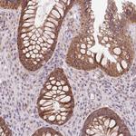 RANBP3L Antibody in Immunohistochemistry (Paraffin) (IHC (P))
