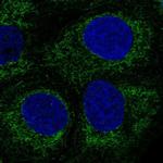 PPP1R3E Antibody in Immunocytochemistry (ICC/IF)