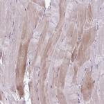 PPP1R3E Antibody in Immunohistochemistry (Paraffin) (IHC (P))