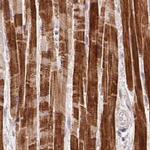 FAM168B Antibody in Immunohistochemistry (IHC)