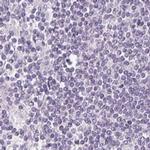 FAM168B Antibody in Immunohistochemistry (IHC)