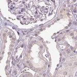 FAM168B Antibody in Immunohistochemistry (IHC)