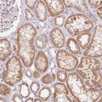 MICS1 Antibody in Immunohistochemistry (Paraffin) (IHC (P))
