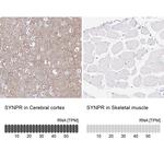 Synaptoporin Antibody in Immunohistochemistry (IHC)