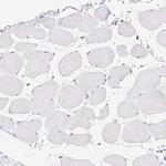 Synaptoporin Antibody in Immunohistochemistry (IHC)
