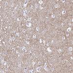 Synaptoporin Antibody in Immunohistochemistry (IHC)