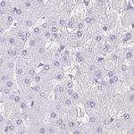 Synaptoporin Antibody in Immunohistochemistry (IHC)