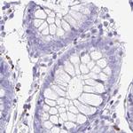 Synaptoporin Antibody in Immunohistochemistry (IHC)