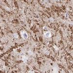 Synaptoporin Antibody in Immunohistochemistry (IHC)