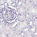 Synaptoporin Antibody in Immunohistochemistry (IHC)