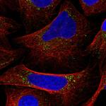 DRAM2 Polyclonal Antibody