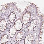 DRAM2 Antibody in Immunohistochemistry (Paraffin) (IHC (P))