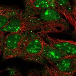 LIN28B Polyclonal Antibody