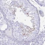 SPAG4 Polyclonal Antibody