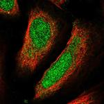 Ubiquilin 4 Antibody in Immunocytochemistry (ICC/IF)