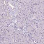 CTNNA3 Antibody in Immunohistochemistry (IHC)