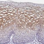 MRCK gamma Polyclonal Antibody