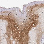 MRCK gamma Antibody in Immunohistochemistry (IHC)