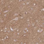 MRCK gamma Antibody in Immunohistochemistry (IHC)