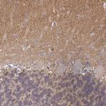 MRCK gamma Antibody in Immunohistochemistry (IHC)