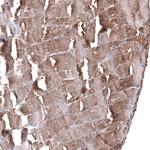 SMCO1 Antibody in Immunohistochemistry (Paraffin) (IHC (P))