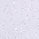 SMCO1 Antibody in Immunohistochemistry (Paraffin) (IHC (P))