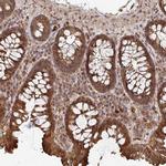 OR4C15 Antibody in Immunohistochemistry (Paraffin) (IHC (P))