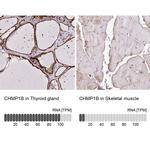 CHMP1B Antibody in Immunohistochemistry (IHC)