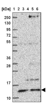 ATP6V1F Antibody in Western Blot (WB)