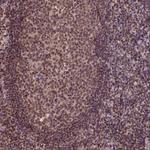 CSTF2T Antibody in Immunohistochemistry (Paraffin) (IHC (P))