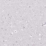 FDX1 Antibody in Immunohistochemistry (IHC)