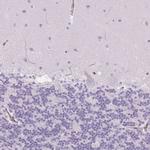 TMEM45A Antibody in Immunohistochemistry (Paraffin) (IHC (P))