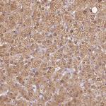 TMEM45A Antibody in Immunohistochemistry (Paraffin) (IHC (P))