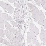 TMEM45A Antibody in Immunohistochemistry (Paraffin) (IHC (P))