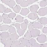 TRPML3 Antibody in Immunohistochemistry (IHC)