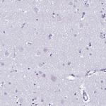 OVGP1 Polyclonal Antibody