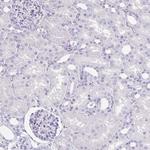 MAGEC2 Antibody in Immunohistochemistry (Paraffin) (IHC (P))