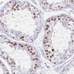 MAGEC2 Antibody in Immunohistochemistry (Paraffin) (IHC (P))