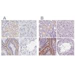 C19orf21 Antibody in Immunohistochemistry (IHC)