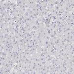 C19orf21 Antibody in Immunohistochemistry (IHC)