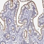 C19orf21 Antibody in Immunohistochemistry (IHC)