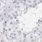 C19orf21 Antibody in Immunohistochemistry (IHC)