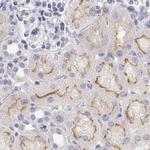 C19orf21 Antibody in Immunohistochemistry (IHC)