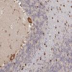 Pellino 3 Antibody in Immunohistochemistry (IHC)