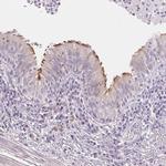 TEKT1 Polyclonal Antibody